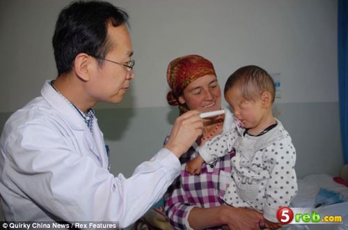 هل تعلم .......طفل الصيني الذي ولد بدون عيون - صور Image