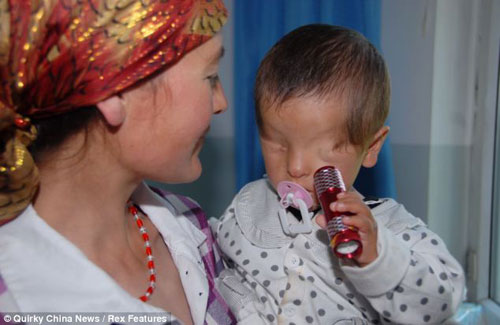 هل تعلم .......طفل الصيني الذي ولد بدون عيون - صور Image